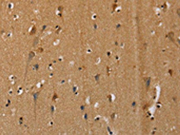 CENPU Antibody (PACO16696)