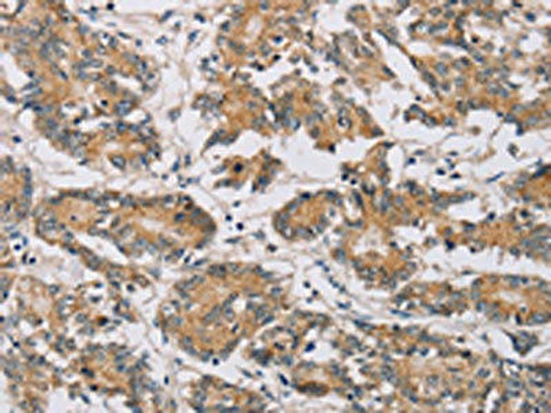 MTFR1 Antibody (PACO16715)