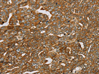 PLEKHG6 Antibody (PACO16724)