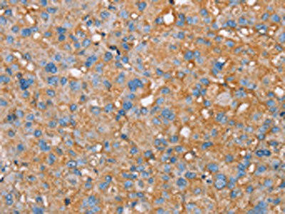 PAGE5 Antibody (PACO16828)