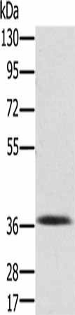PDLIM2 Antibody (PACO16850)