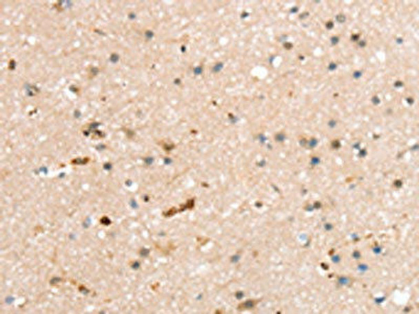 RASGEF1A Antibody (PACO16945)