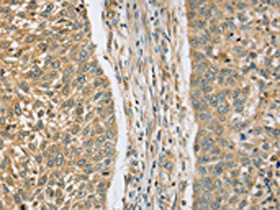 RASSF4 Antibody (PACO16947)