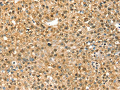 RASSF9 Antibody (PACO16949)