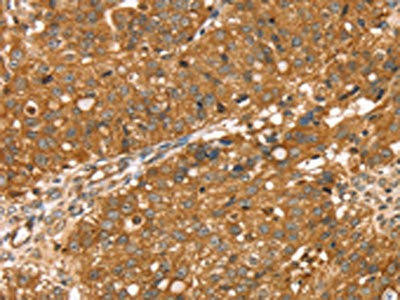 RNASET2 Antibody (PACO16983)