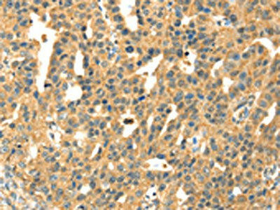SAMD7 Antibody (PACO17046)