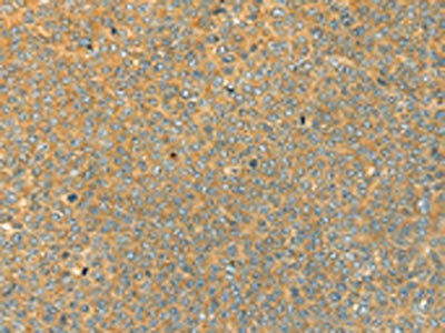 SAMD7 Antibody (PACO17047)