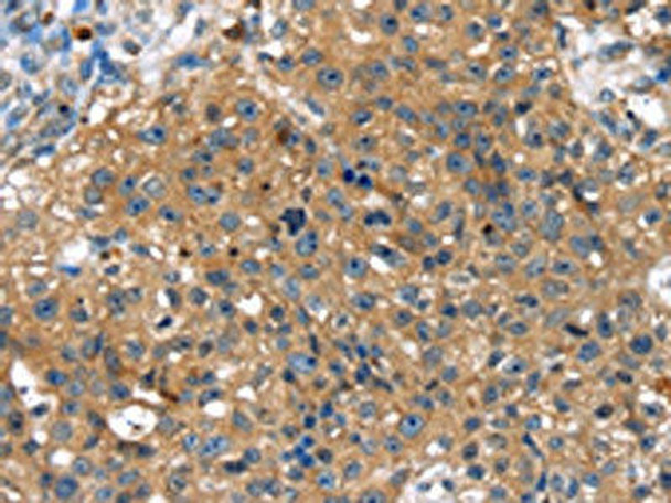 TBX10 Antibody (PACO17218)