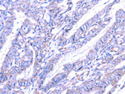 THAP6 Antibody (PACO17233)