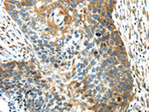 TMED4 Antibody (PACO17272)