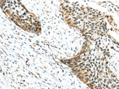 TRIP6 Antibody (PACO17320)