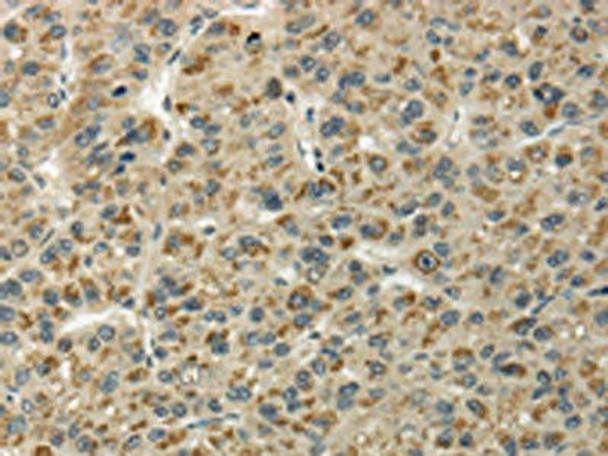UBL4B Antibody (PACO17357)