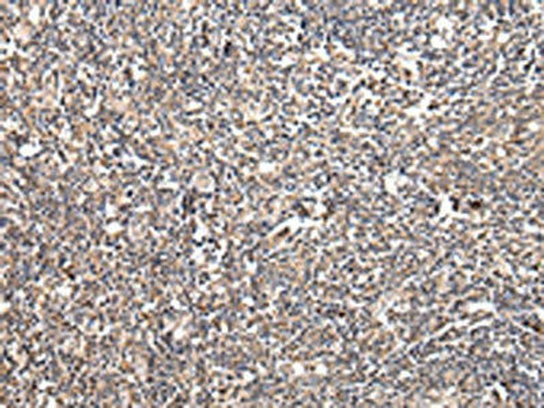 UGGT2 Antibody (PACO17362)