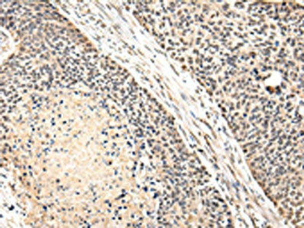 VPS41 Antibody (PACO17434)