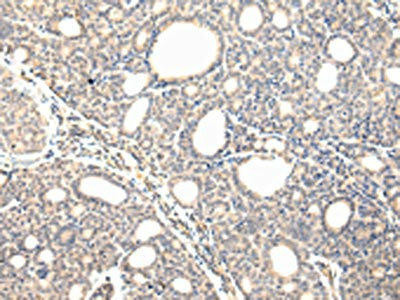 VPS37D Antibody (PACO17447)