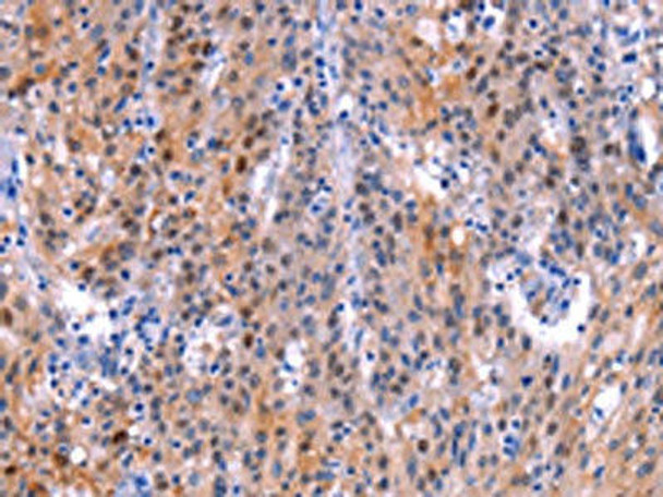 ADM2 Antibody (PACO17492)