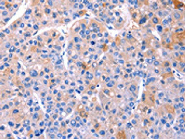 ADM2 Antibody (PACO17493)