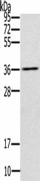 UBXN2A Antibody (PACO17563)