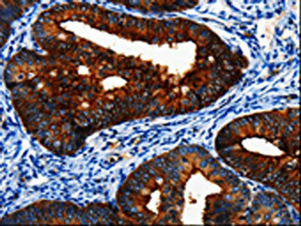 BIRC6 Antibody (PACO17594)