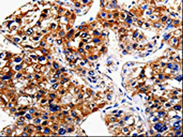 BIRC6 Antibody (PACO17595)