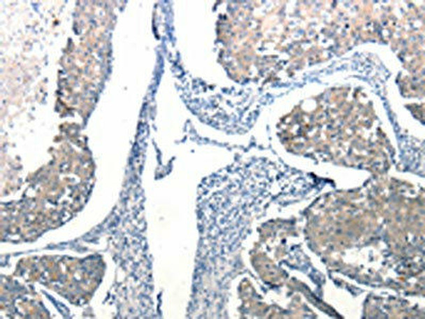 Ccl6 Antibody (PACO17661)