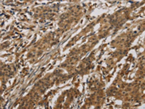 CLEC2A Antibody (PACO17707)