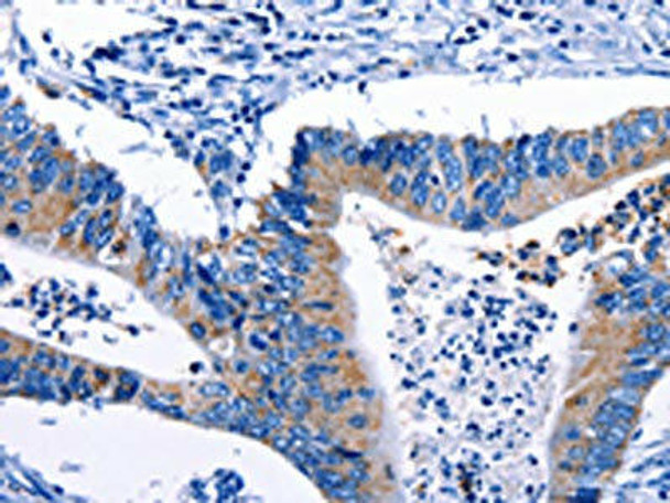 Gjc3 Antibody (PACO17742)