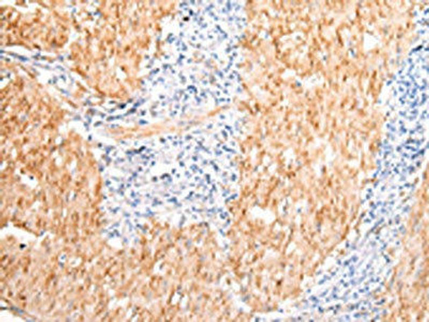 DMBT1 Antibody (PACO17791)