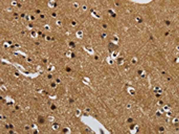 GATA5 Antibody (PACO17937)