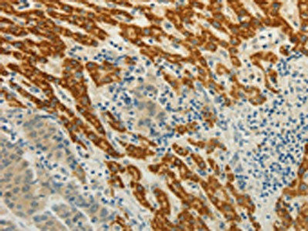 CMTM7 Antibody (PACO17940)