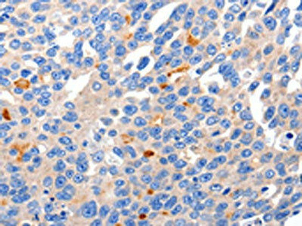 KCNH8 Antibody (PACO18046)