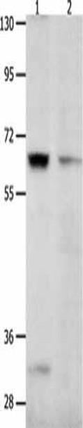 KCNC2 Antibody (PACO18130)