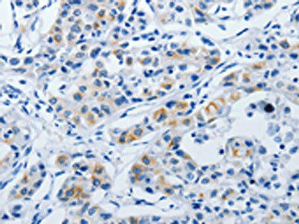 BPIFB3 Antibody (PACO18162)
