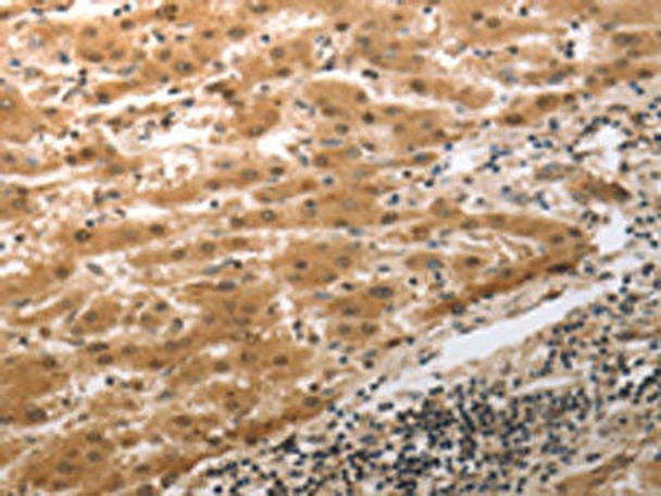 MMP27 Antibody (PACO18242)