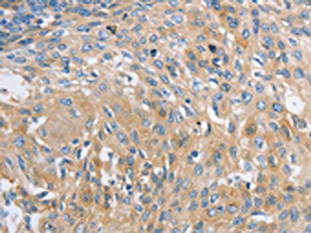 NBEA Antibody (PACO18286)