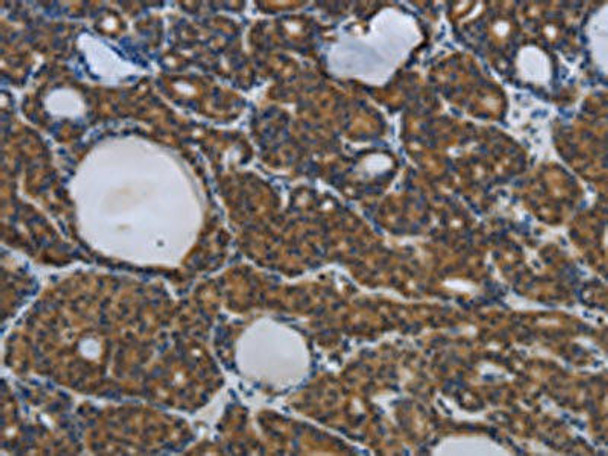 SPAG4 Antibody (PACO18427)