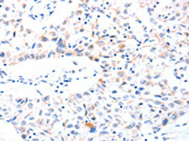 SPAG4 Antibody (PACO18428)