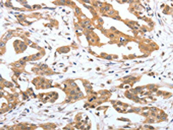 PSPN Antibody (PACO18430)