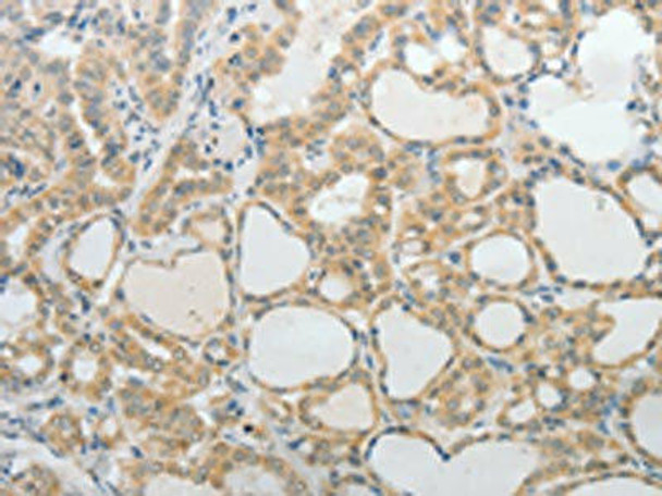UCN Antibody (PACO18476)