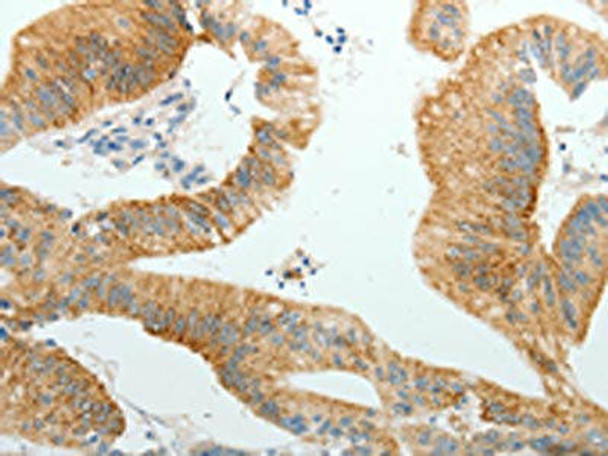 PGBD5 Antibody (PACO18488)
