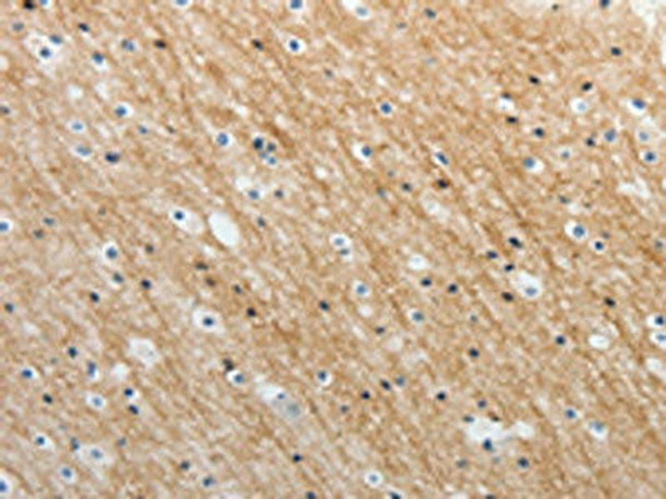 ADAMTS19 Antibody (PACO18514)