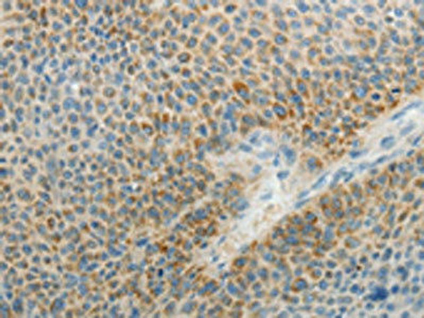 AGAP1 Antibody (PACO18527)