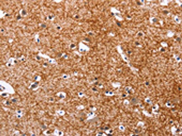 APMAP Antibody (PACO18573)