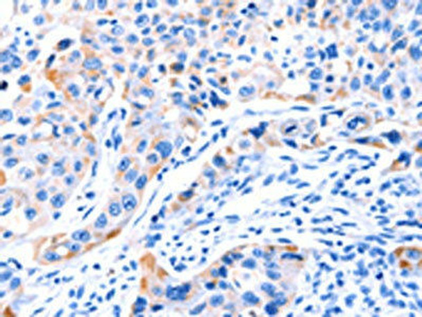 SMG8 Antibody (PACO18645)
