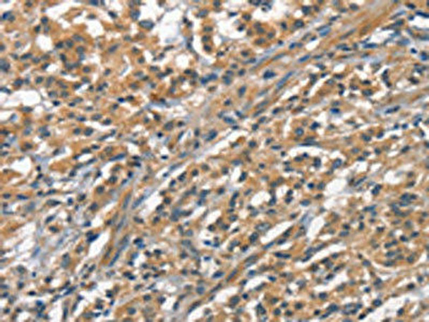 ACPT Antibody (PACO18647)