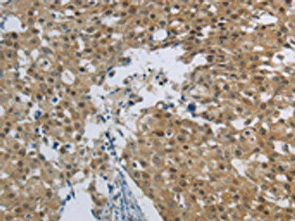 HMGN5 Antibody (PACO18784)