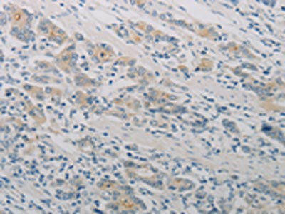 PTAFR Antibody (PACO18800)