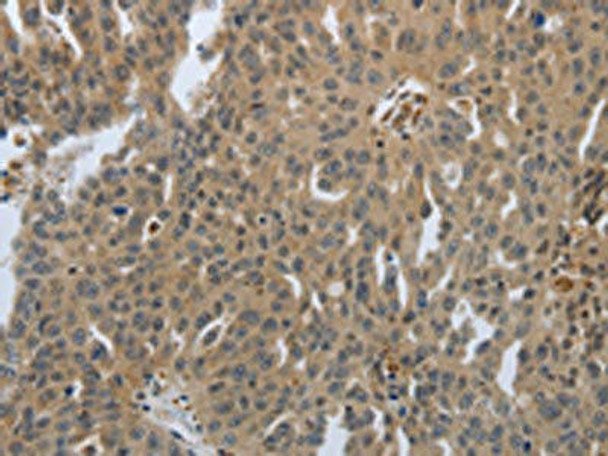 PTPRT Antibody (PACO18858)