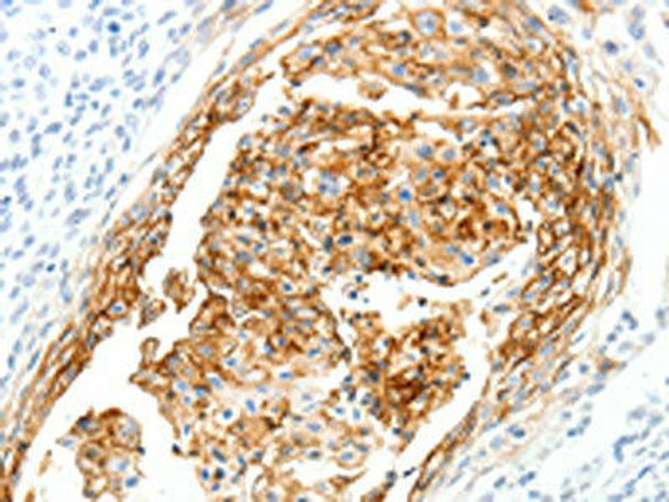SEMA3D Antibody (PACO18888)