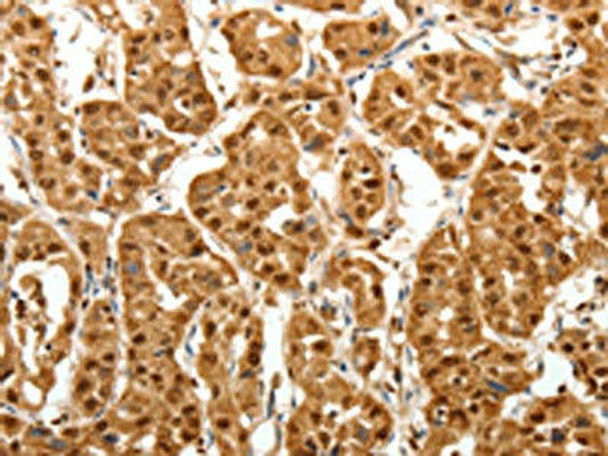 TNN Antibody (PACO18956)